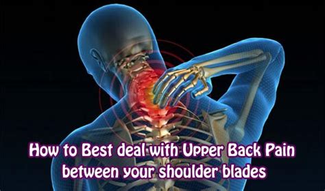Sometimes the pain goes up to my neck and down my back. Mobilize your Back & Improve your Posture! Advanced ...