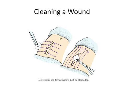 Ppt Nursing Care For Patient With Wound Powerpoint Presentation Free