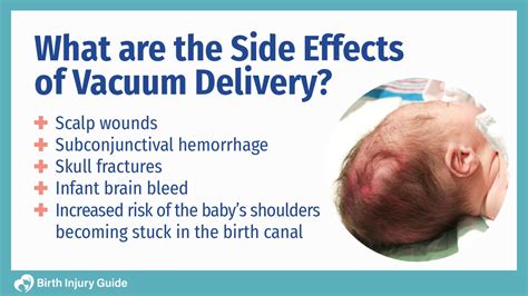 What Are The Side Effects Of Assisted Delivery Birth Injury Guide