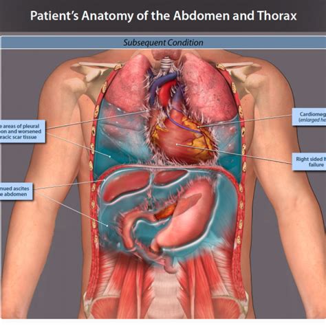 Divided into 9 regions by two vertical and two horizontal imaginary planes. Patient's Anatomy of the Abdomen and Thorax Following Radiation - TrialExhibits Inc.