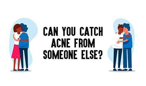can you catch acne from someone else neostopzone