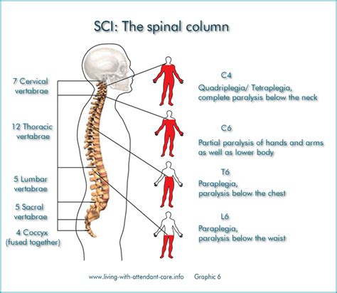 Spinal Cord Injury Neuro Respiratory And Recovery Physiotherapy