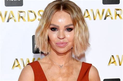 Katie Piper “i Relied On Alcohol To Get Me Through Dark Times”