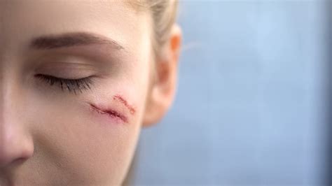 Close Up Of Young Female Face With Deep Scars Domestic Violence Victim
