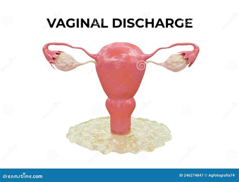 Vaginal Discharge Concept Illustration In Cute Or Kawaii Style Cartoondealer Com