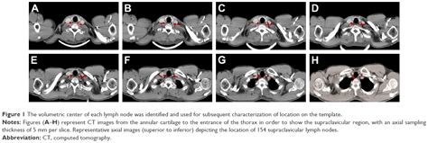 Supraclavicular Lymph Nodes Ct Imaging Of Head And Neck Lymph Nodes