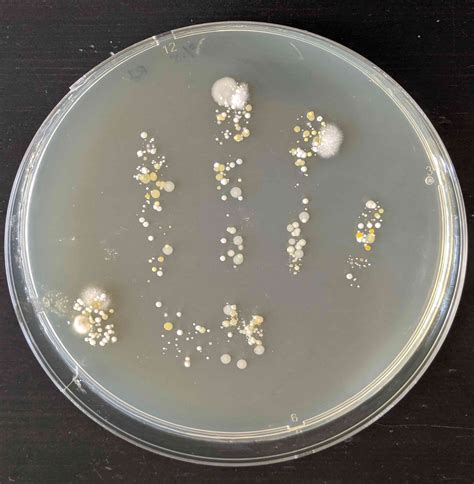 Pin On Bacteria Science Experiment Grown On The Plates