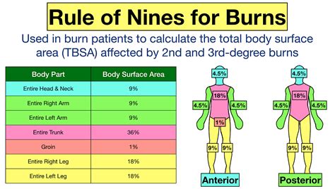 Rule Of Nines For Burns Child And Adult Chart Calculator Definition