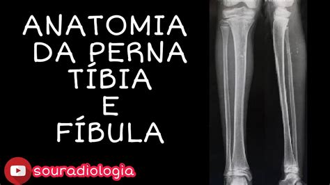 Anatomia Dos Ossos Da Pernatíbia E Fíbula Radiologia Youtube