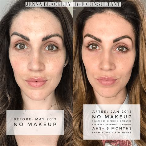 Dull Skin Before After