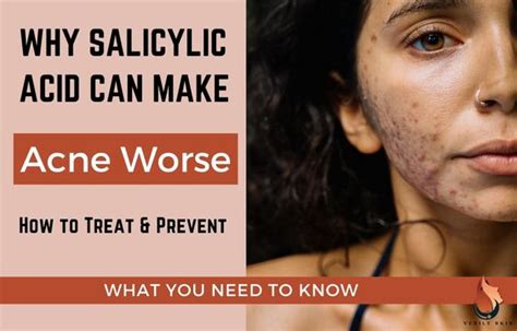 Reasons Salicylic Acid Can Make Acne Worse What To Do Sasily Skin