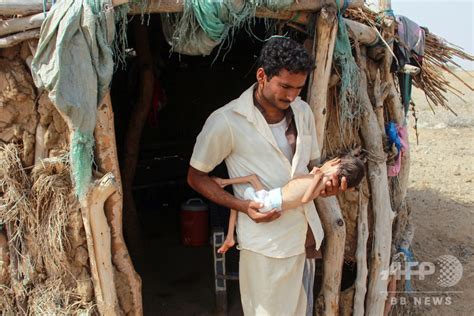 イエメンの子ども数百万人、「飢餓の瀬戸際」に？ コロナ禍で資金援助減 写真8枚 国際ニュース：afpbb News