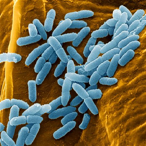 Pseudomonas Aeruginosa Bacteria Sem Photograph By Juergen Berger