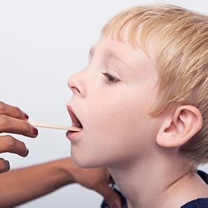 Lesen sie mehr über ihre symptome, behandlung und vorbeugung! Mundfäule - Infos zu Stomatitis aphthosa | GMX