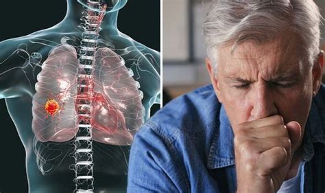 Lung Cancer Symptoms Include Hemoptysis Known As Coughing Up Blood