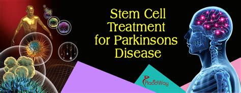 Stem Cell Therapy For Parkinson Disease Treatment Abroad