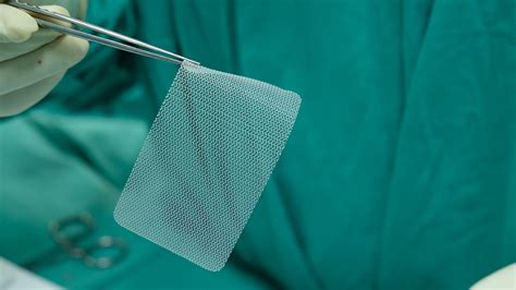 Hernia Mesh Lawsuits Complications Injuries Simmons Hanly Conroy