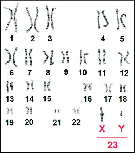 Cariotipo Humano Normal Los Cromosomas X E Y Forman El Par 23 Y Son