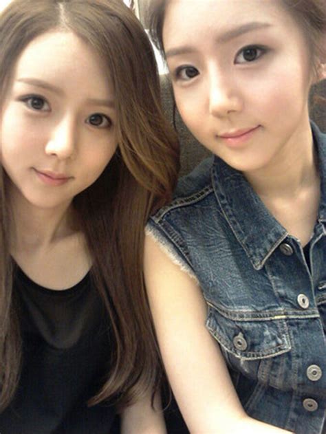 Korean Twin Sisters Thought They Were Ugly Thus Had Plastic Surgery