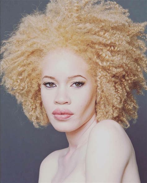 Афроамериканец альбинос фото Черная магия Черного континента Кто и