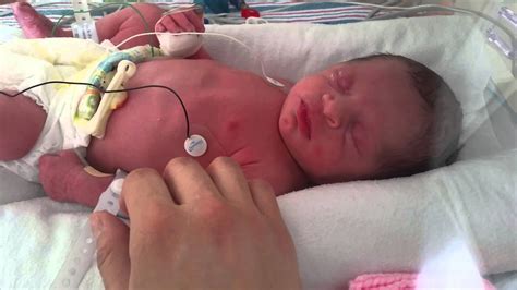 Preemie Baby At 33 Weeks Youtube