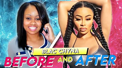 Blac Chyna Before And After Plastic Surgery Transformation Youtube