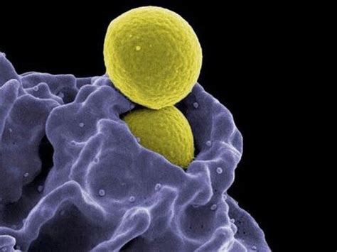 White Blood Cell Engulfing Bacteria Medizzy