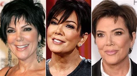 Kris Jenner S Plastic Surgery Journey In Full From Boob Jobs To Botox