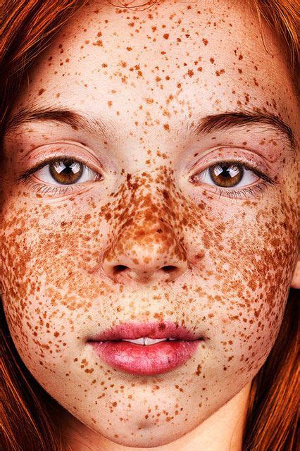 Breathtaking Photos Show The Undeniable Beauty Of Freckles Huffpost