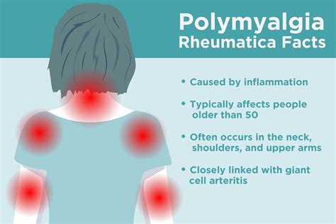 Polymyalgia Rheumatica Symptoms Causes Risk Factors And Complications