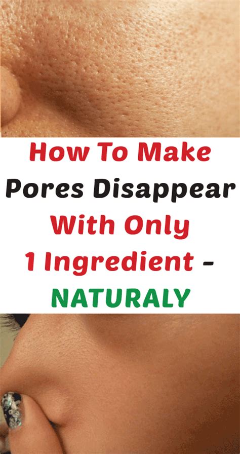 How To Make Pores Disappear With Only 1 Ingredient Naturally Smaller