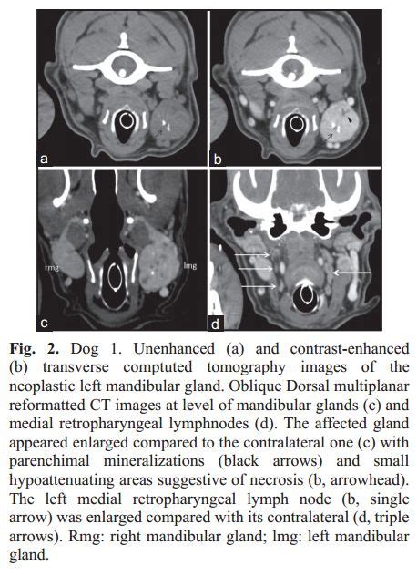 Ultrasound And Multidetector Computed Tomography Of Mandibular Salivary