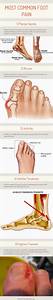 Foot Symptom Chart