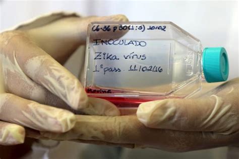 Zika Link To Microcephaly Proof Soon Who