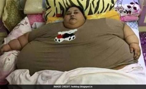 Woman With 500kg Weight Is Believed To Be Fattest In The World