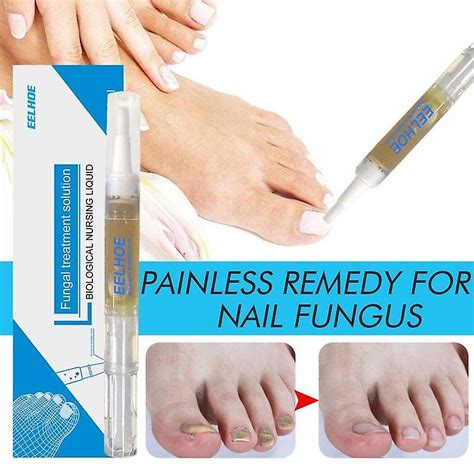 Fungal Nail Liquid Treatment Pen Onychomycosis Paronychia Anti Fungal