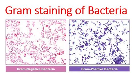 What Step In The Gram Stain Is Most Critical Normantrust
