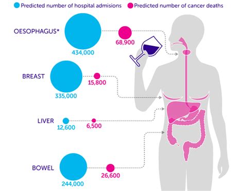 135000 Alcohol Related Cancer Deaths Predicted By 2035