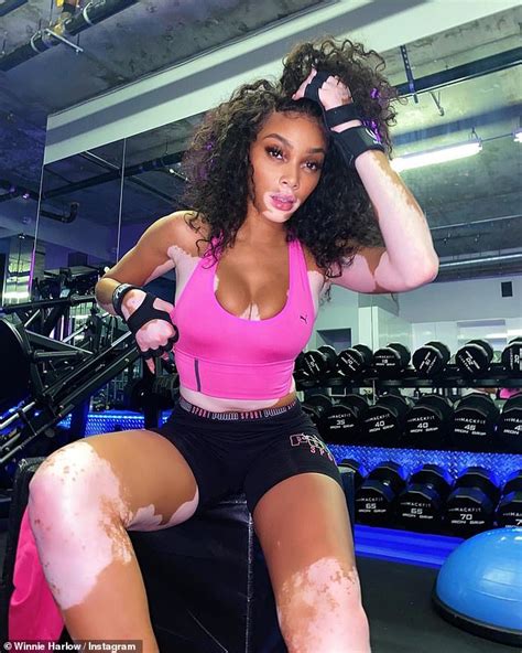Winnie Harlow Showcases Her Incredible Physique As She Models In The