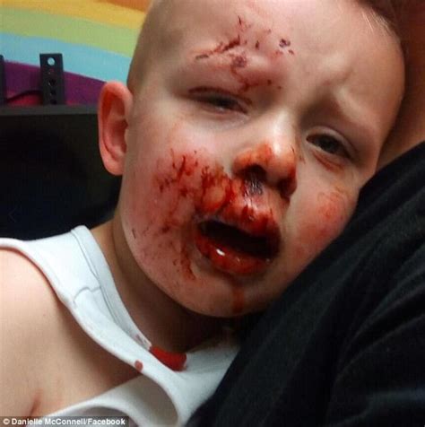Maybe you would like to learn more about one of these? Boy injured by sliding glass door when it shatters | Daily ...