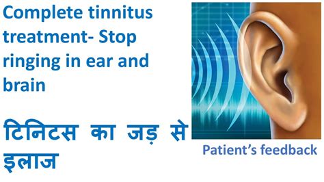 Complete Tinnitus Treatment Stop Ringing In Ear And Brain Youtube