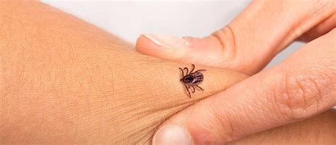 The 3 Surprising Body Parts You Need To Check For Ticks Experts Say