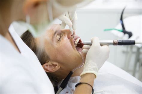 Curetaje Dental En Qué Consiste El Tratamiento Y Qué Beneficios Tiene