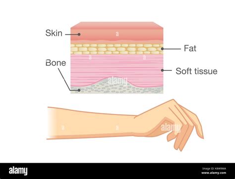Anatomy Of Human Skin Layer And Arm Stock Vector Art And Illustration