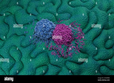 Gastric Stomach Cancer Cells Isometric View 3d Illustration Stock Photo