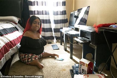 Woman 34 Born With No Arms And Knees Reveals How Shes Planning Her