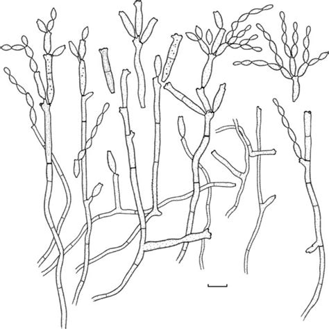 Cladosporium Herbarum Cpc 11600 Macro And Micronematous