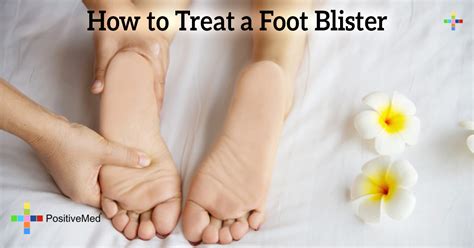 How To Treat A Foot Blister Positivemed