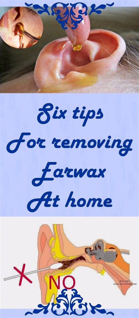 Six Tips For Removing Earwax At Home With Images Ear Wax Natural