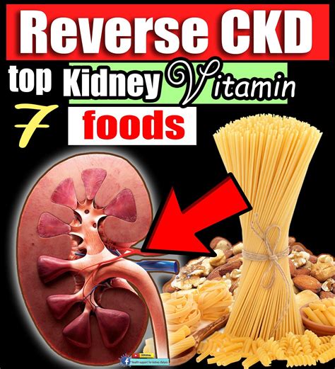 7 Best Kidney Vitamins Foods You Must Eat In A Low Protein Renal Diet